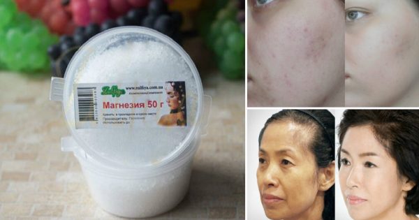 Sales de Epsom: 6 aplicaciones beneficiosas para el cuerpo y la salud…