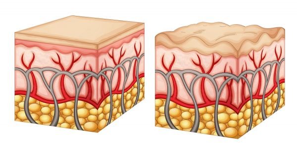 Ella unta los muslos con algo que hay en cada cocina… ¡El efecto no sólo es bueno, es genial!